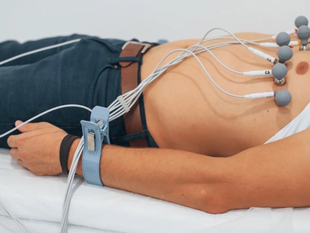 Elektrokardiogrāfija (EKG)